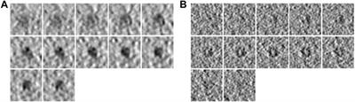 FSCC: Few-Shot Learning for Macromolecule Classification Based on Contrastive Learning and Distribution Calibration in Cryo-Electron Tomography